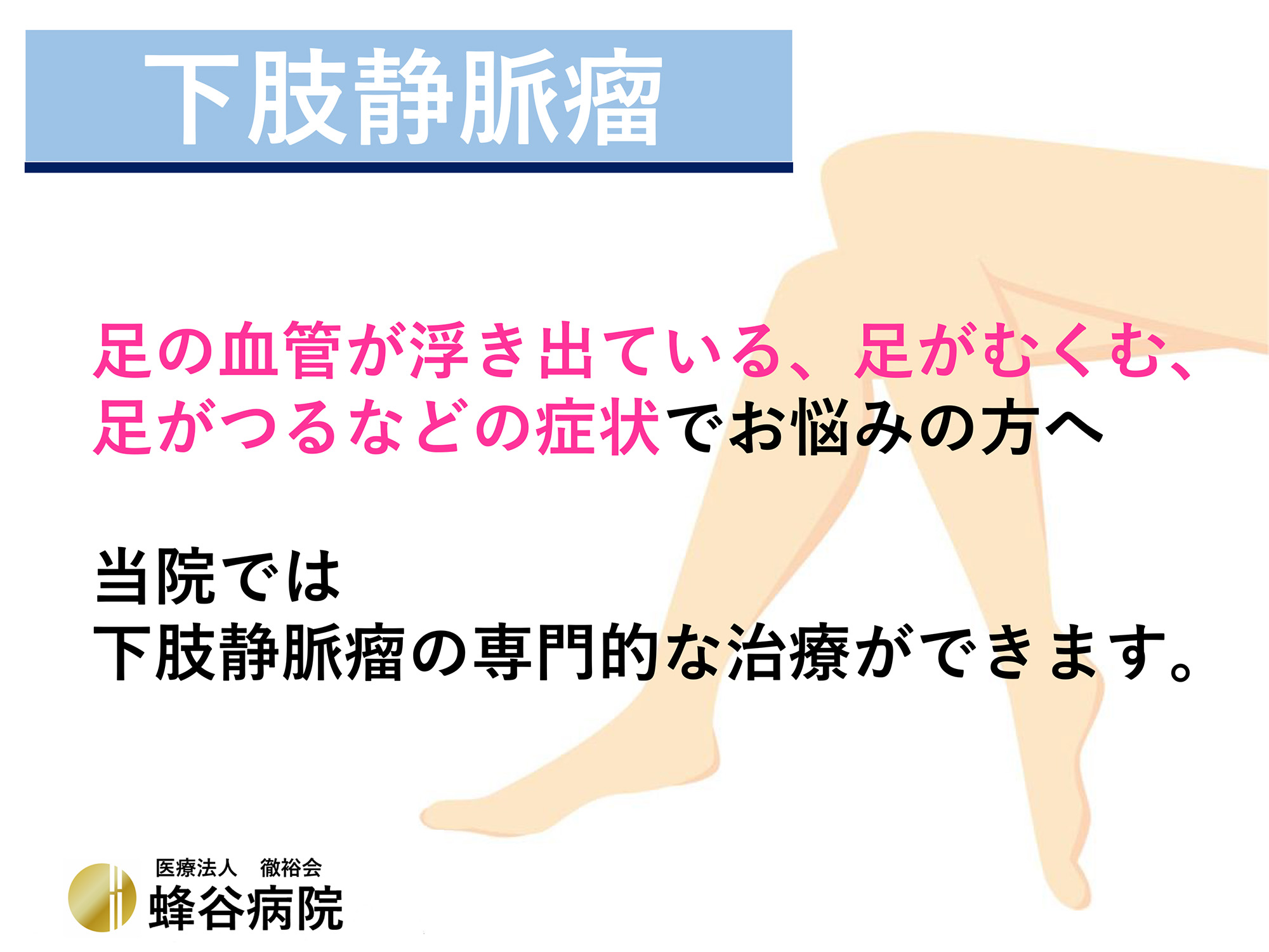 下肢静脈瘤