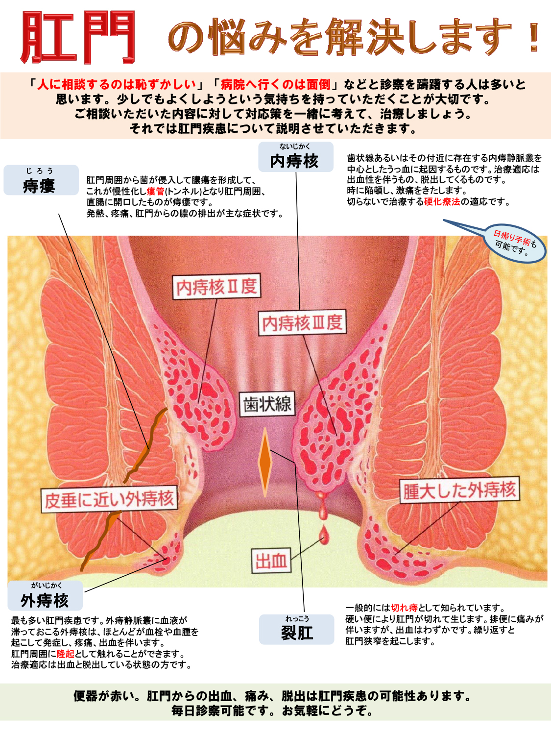 肛門科｜蜂谷病院｜群馬県 大泉町 病院｜外科｜医療法人 徹裕会